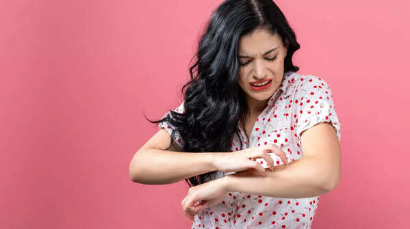 Moles that itch, hurt, or bleed should be checked