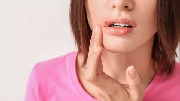 Examining sores that won't heal for possible cancer signs