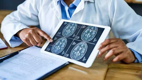 Conceptual image of the human brain