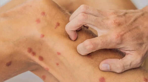 Itchy, tender, or painful spots